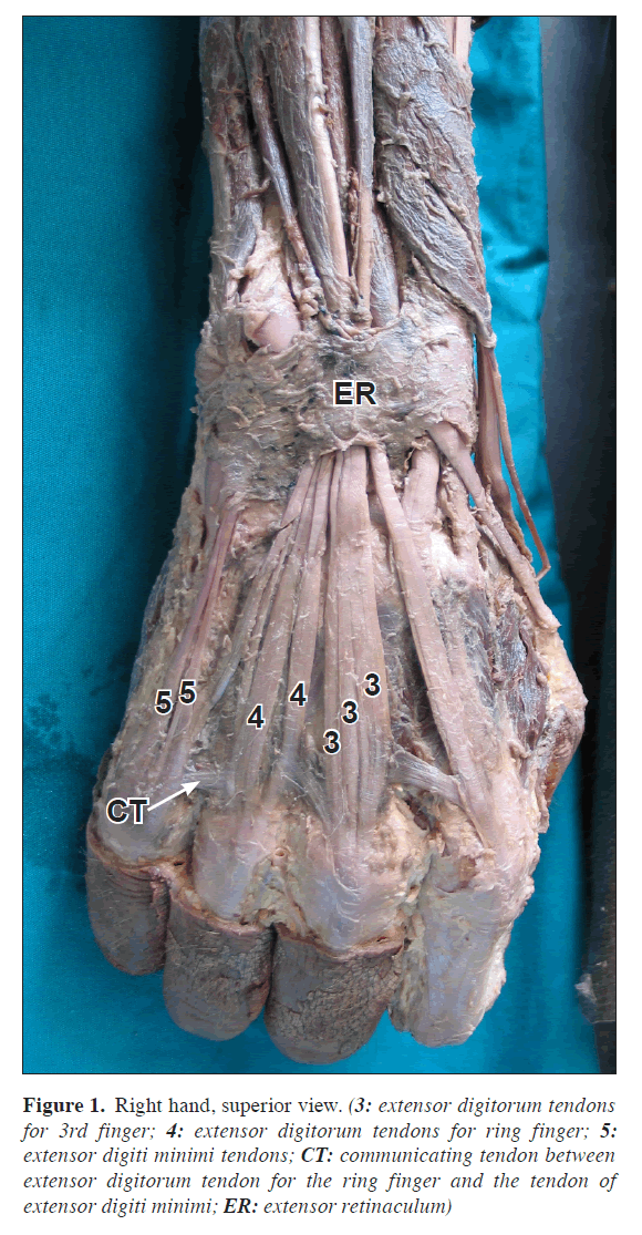 anatomical-variations-superior-view