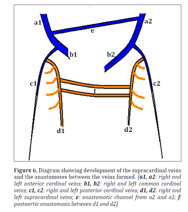 anatomical-variations-supracardinal-veins