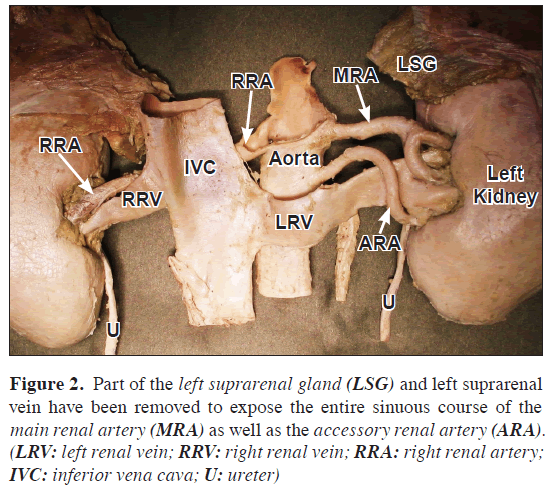 anatomical-variations-suprarenal