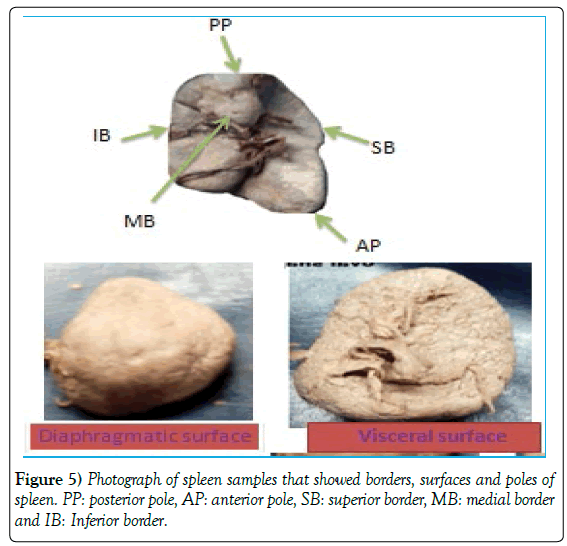 anatomical-variations-surfaces