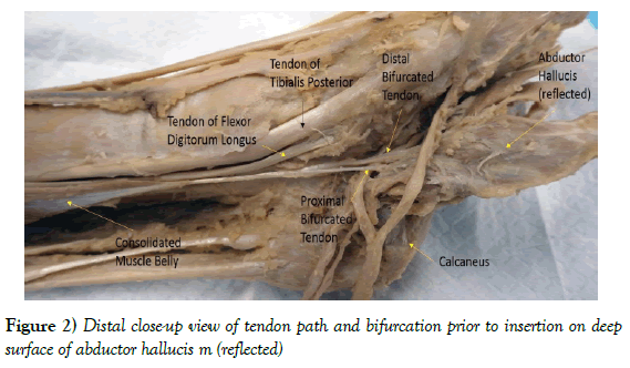 anatomical-variations-tendon-path