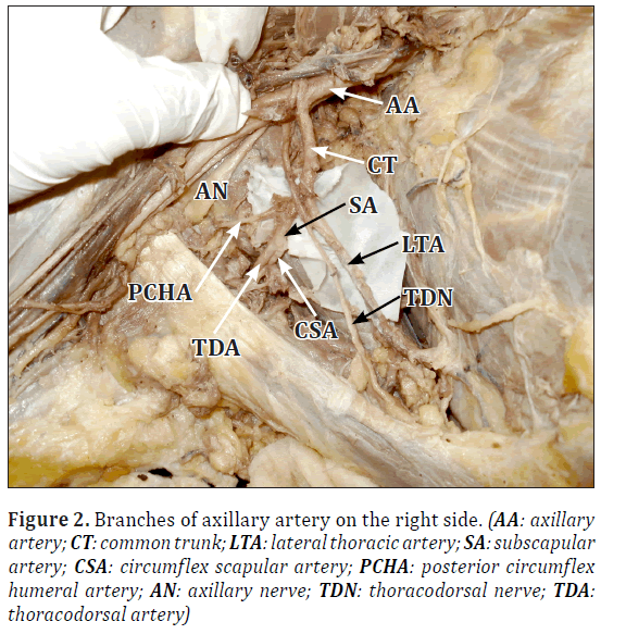 anatomical-variations-thoracodorsal-artery