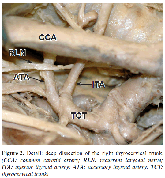 anatomical-variations-thyrocervical-trunk