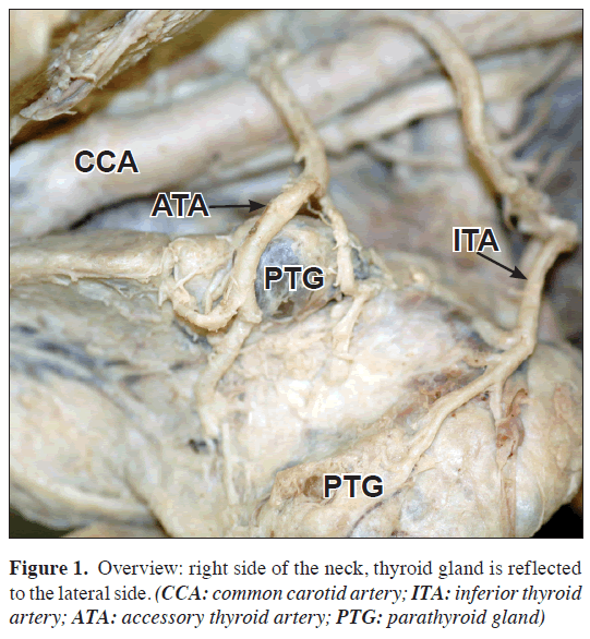 anatomical-variations-thyroid-gland