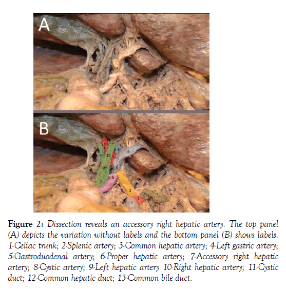 anatomical-variations-top-panel