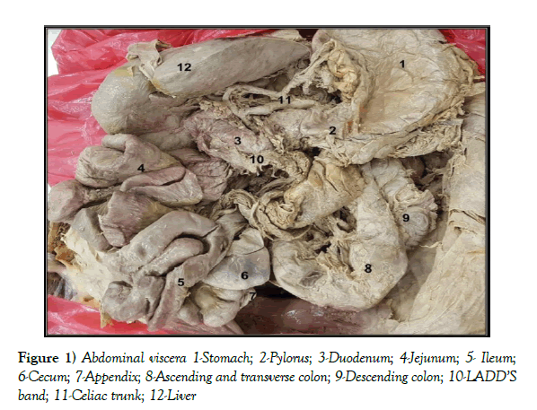 anatomical-variations-transverse-colon