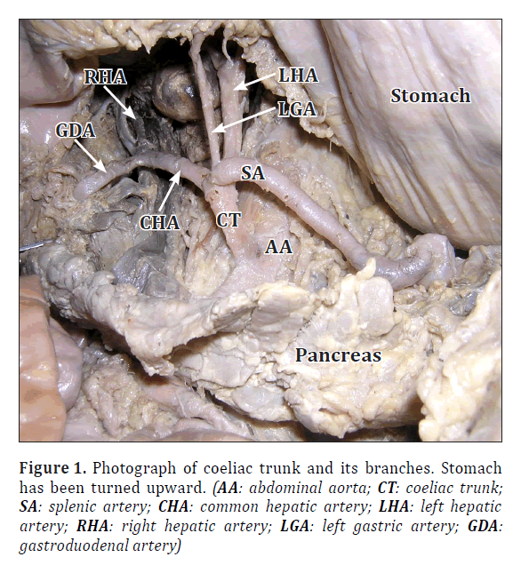 anatomical-variations-turned-upward