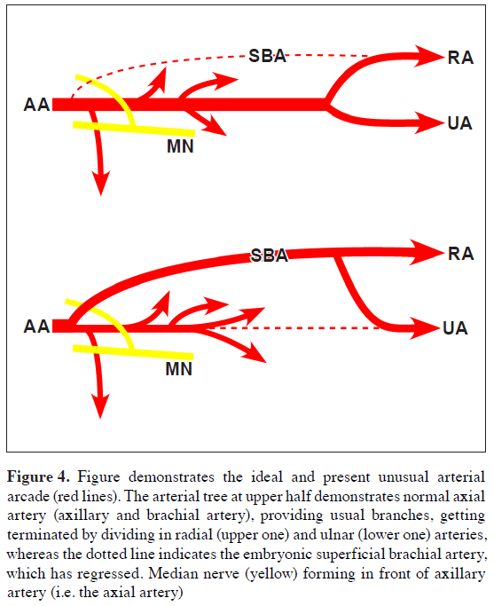 anatomical-variations-unusual-arterial