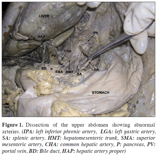 anatomical-variations-upper-abdomen