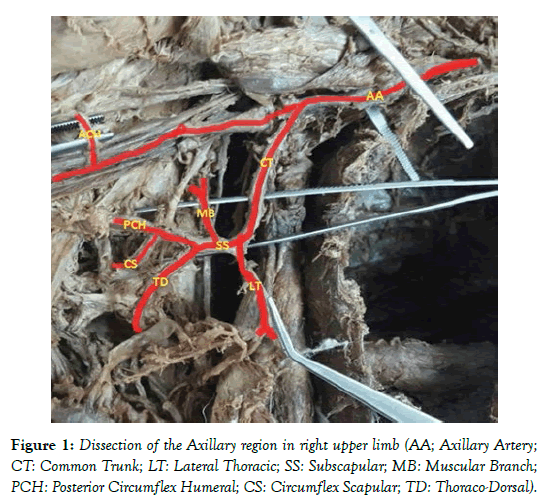 anatomical-variations-upper-limb