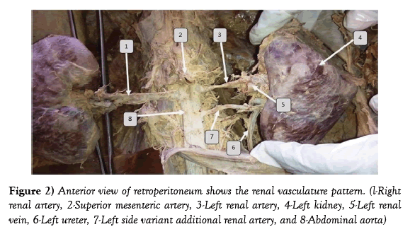 anatomical-variations-variant-additional