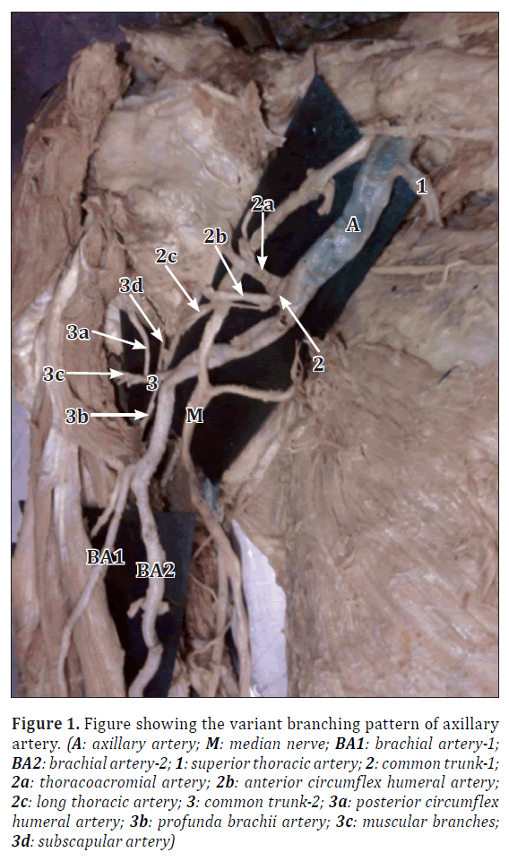 anatomical-variations-variant-branching