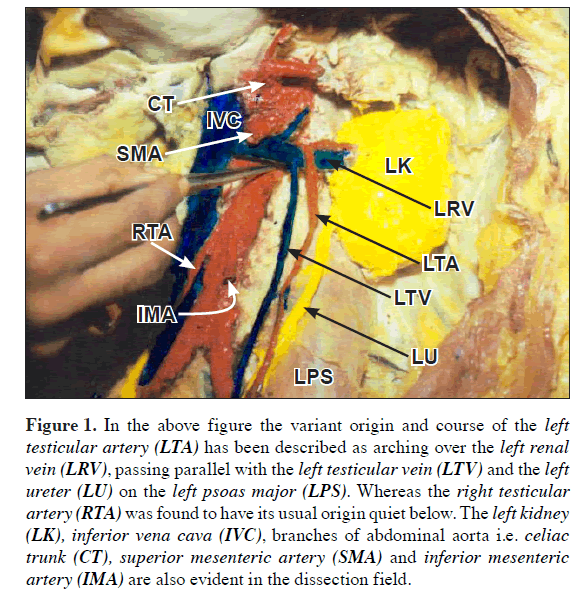 anatomical-variations-variant-origin