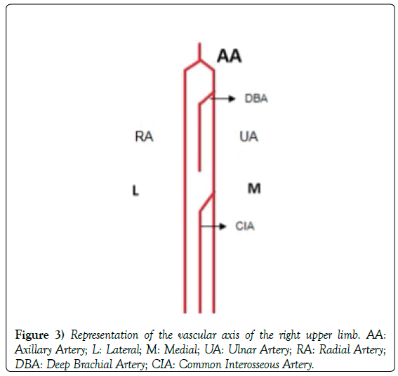 anatomical-variations-vascular-axis