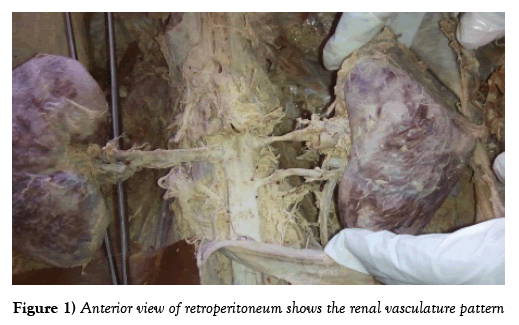 anatomical-variations-vasculature-pattern