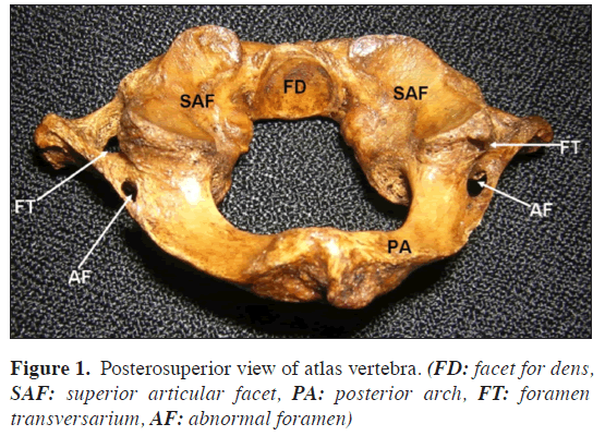 anatomical-variations-vertebra