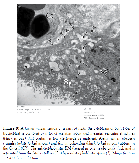 anatomical-variations-vesicular-structures