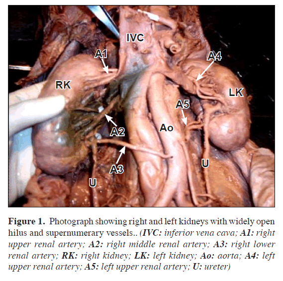 anatomical-variations-widely-open