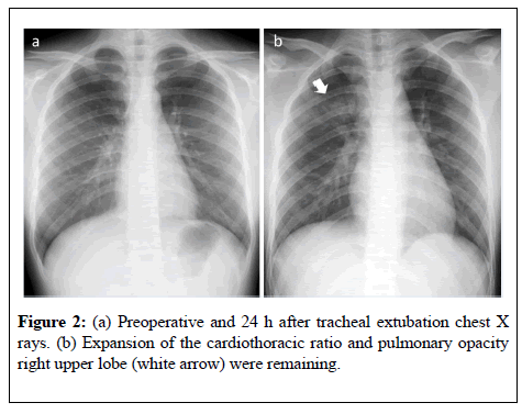 anesthesiology-Expansion-cardiothoracic