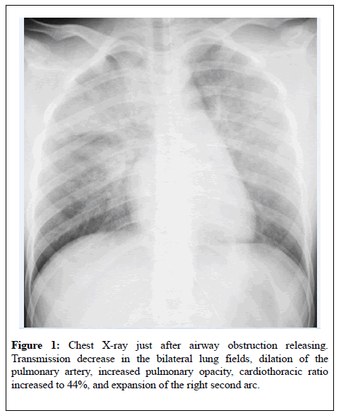 anesthesiology-Transmission-decrease