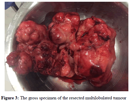 anesthesiology-gross-specimen