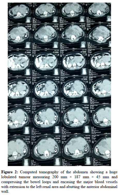 anesthesiology-renal-area