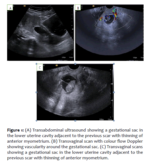 basic-clinical-reproductive-sciences-gestational-sac