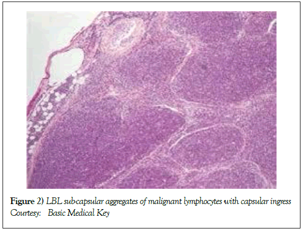 blood-disorders-treatment-aggregates