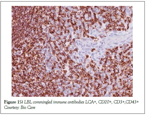 blood-disorders-treatment-antibodies