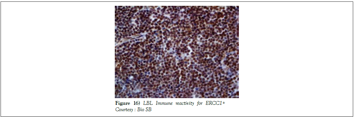 blood-disorders-treatment-antibodies