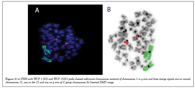 blood-disorders-treatment-chromosome