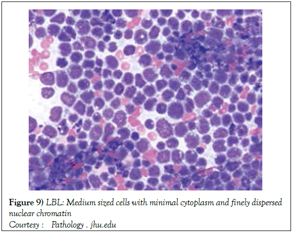 blood-disorders-treatment-dispersed