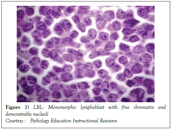blood-disorders-treatment-lymphoblast