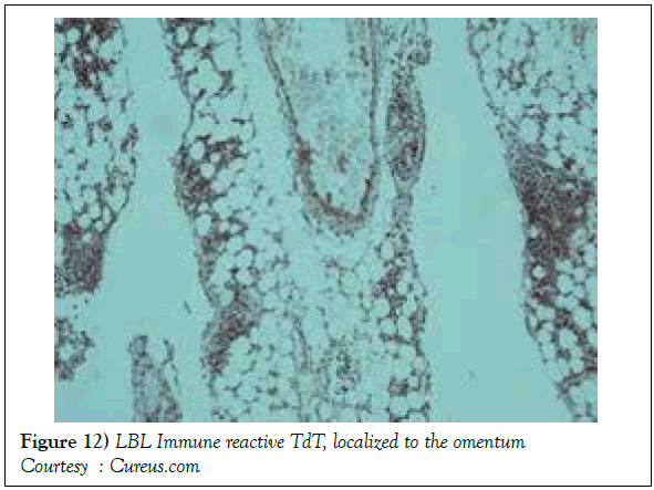 blood-disorders-treatment-reactive