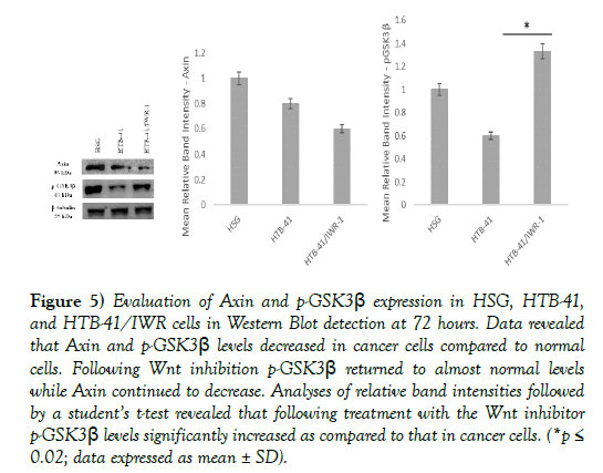 cancer-metastasis-research-Western-Blot