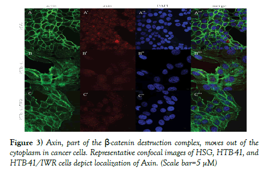 cancer-metastasis-research-catenin-destruction