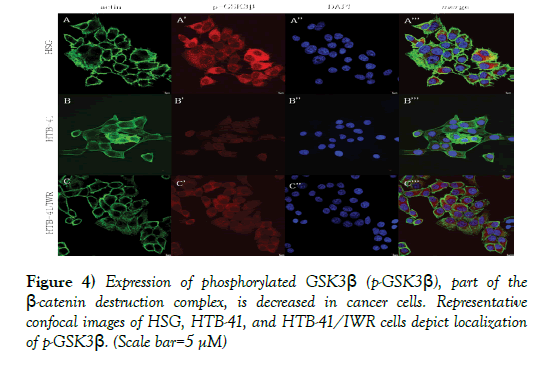 cancer-metastasis-research-destruction-complex