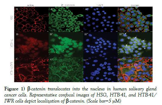 cancer-metastasis-research-human-salivary-gland