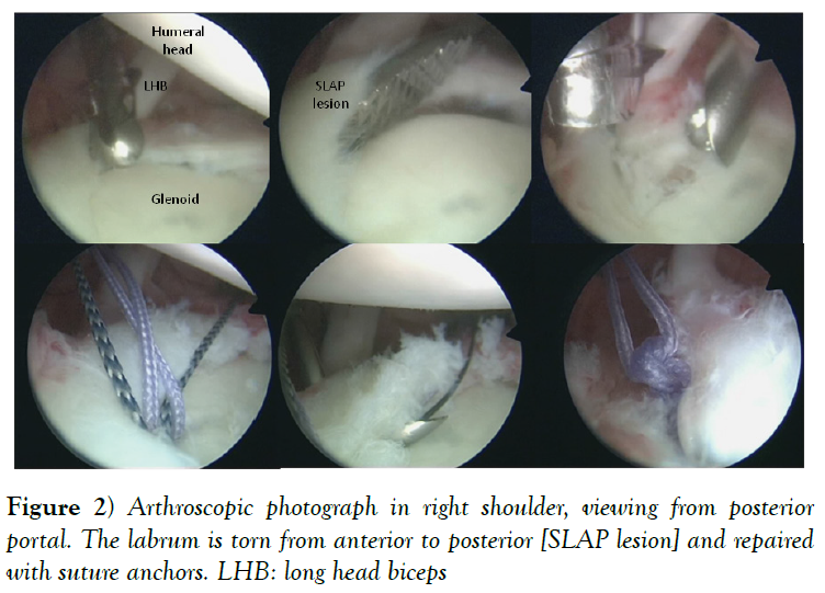 cinical-diagnosis-treatment-anterior-posterior