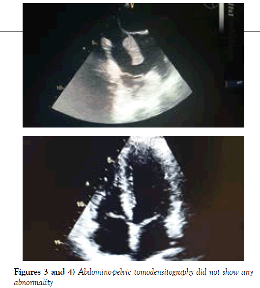 clinical-cardiology-Abdomino-pelvic