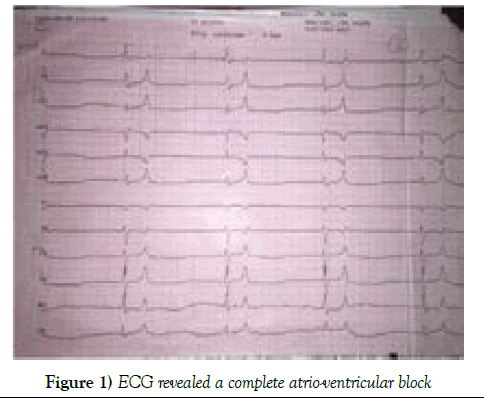 clinical-cardiology-ECG-revealed