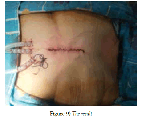 clinical-cardiology-The-result