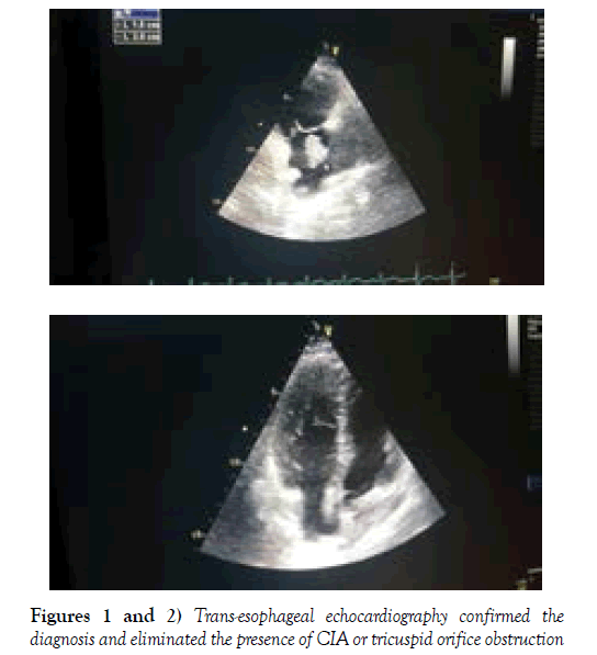 clinical-cardiology-Trans-esophageal