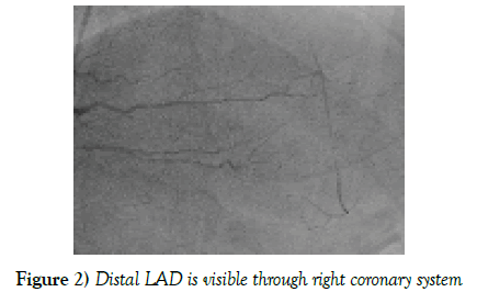 clinical-cardiology-coronary-system