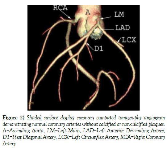 clinical-cardiology-display-coronary