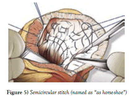 clinical-cardiology-horse-shoe