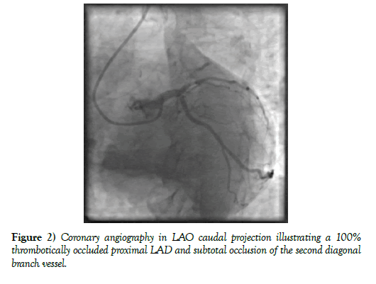 clinical-cardiology-journal-angiography