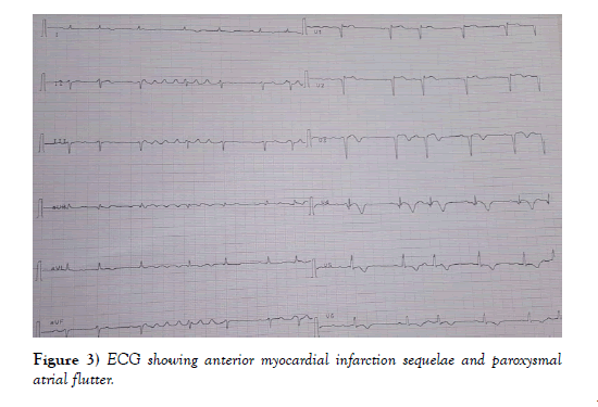 clinical-cardiology-journal-anterior