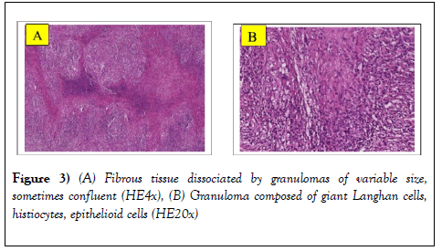 clinical-cardiology-journal-dissociated