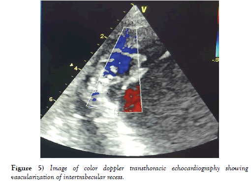 clinical-cardiology-journal-echocardiography
